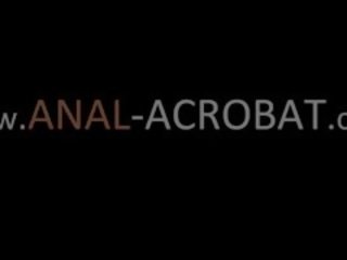 Три анус повії їжа пролапс
