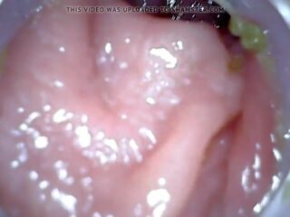 アナル endoscope パート 1, フリー 浣腸 罰 高解像度の xxx クリップ 04